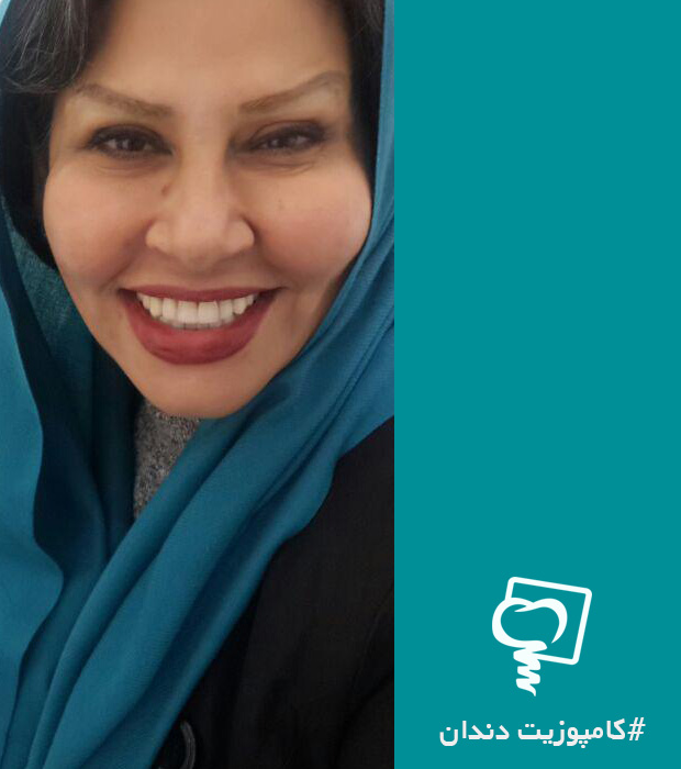 کامپوزیت دندان