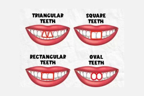 انواع-فرم-دندان