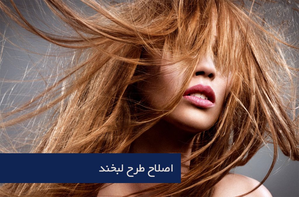 اصلاح طرح لبخند