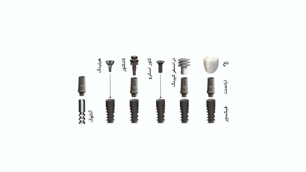 اجزای تشكيل دهنده ايمپلنت دندان