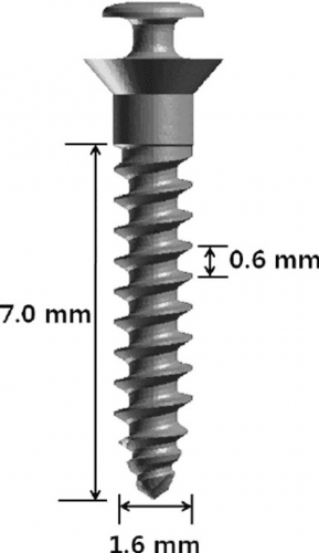 مینی ایمپلنت