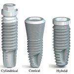 taper implants