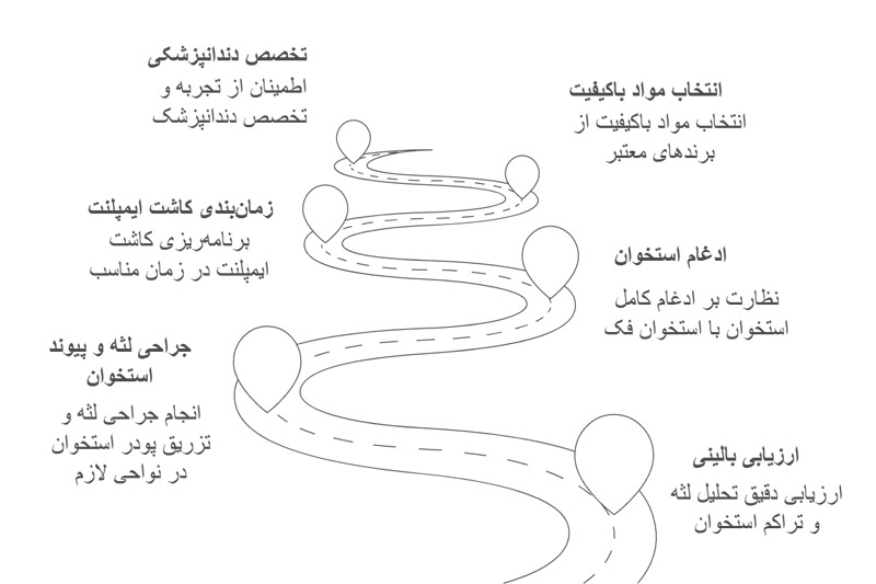 عوامل-مؤثر-بر-موفقیت-کاشت-ایمپلنت