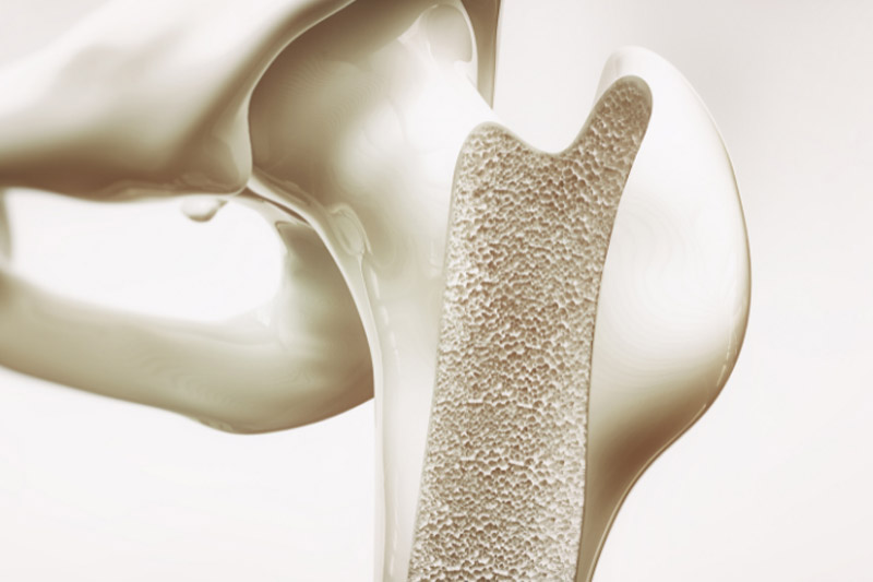 پوکی-استخوان