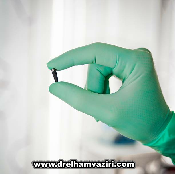 بیهوشی برای ایمپلنت دندان