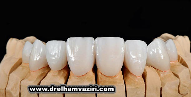 آیا دیابت می تواند ایمپلنت دندان را دشوار کند