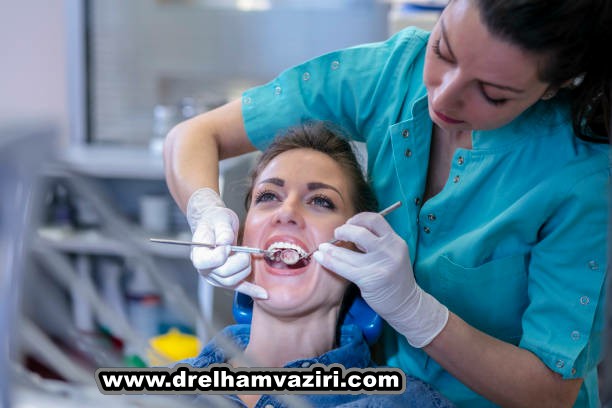 پل ایمپلنت دندان چیست