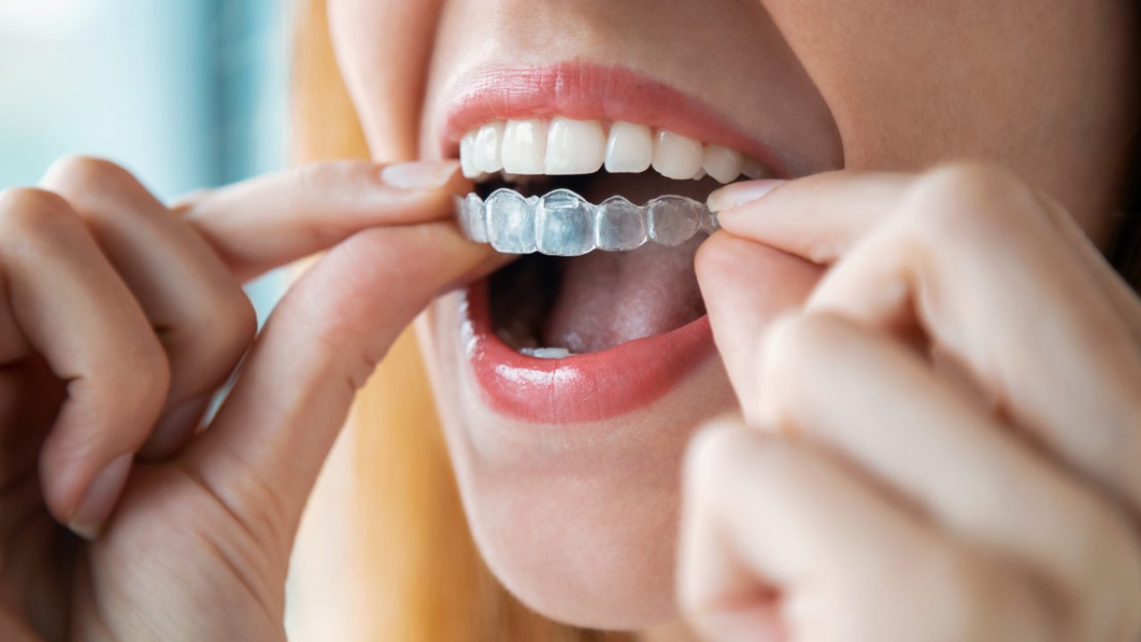 نایت گارد دندان قورچه