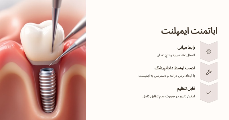 اباتمنت ایمپلنت