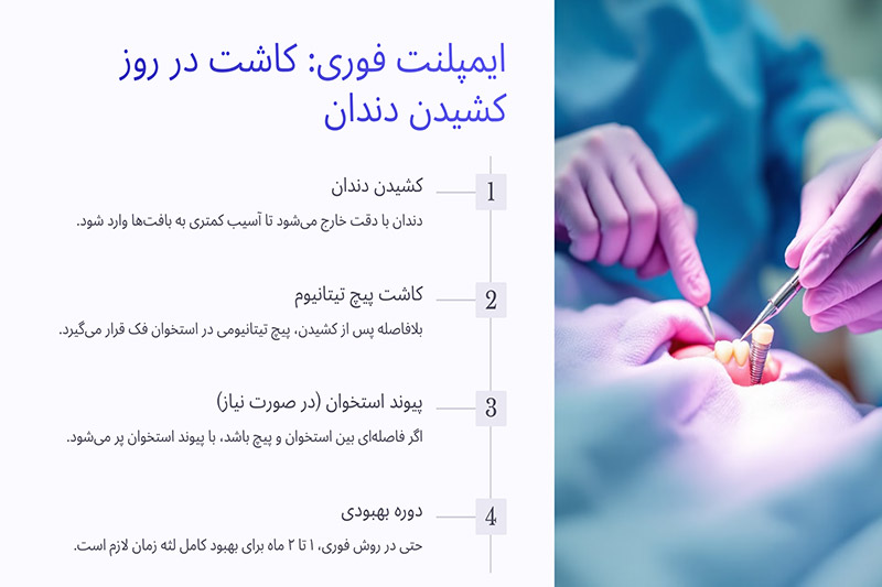 ایمپلنت-فوری-در-همان-روز-کشیدن-دندان