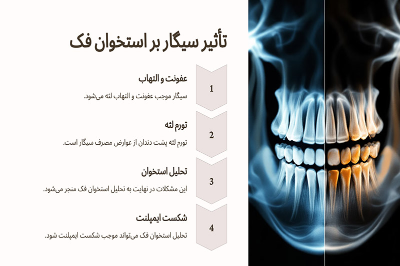 تآثیر-مصرف-سیگار-بر-استخوان-فک