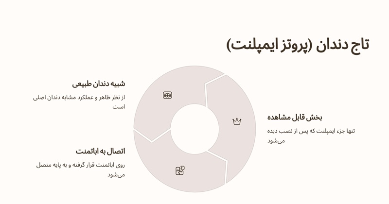 تاج دندان (پروتز ایمپلنت)