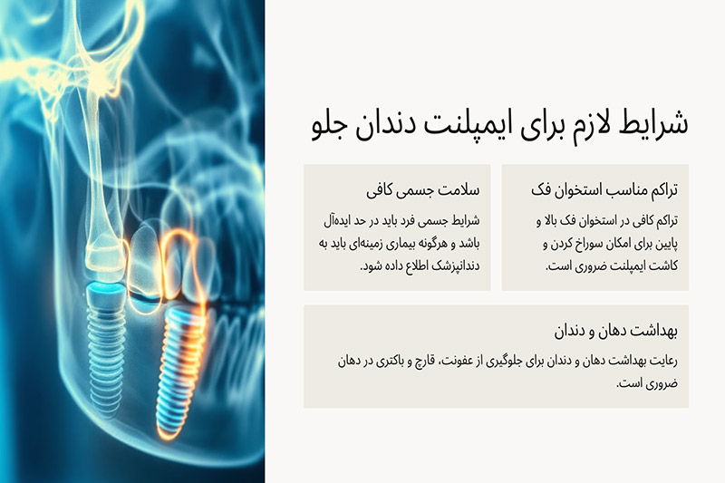 شرایط-خاص-برای-ایمپلنت-دندان-های-جلو