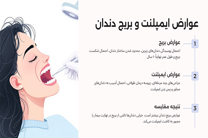 عوارض-ایمپلنت-دندان-بیشتر-است-یا-بریج-دندان