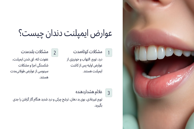 عوارض-ایمپلنت-دندان-چیست؟