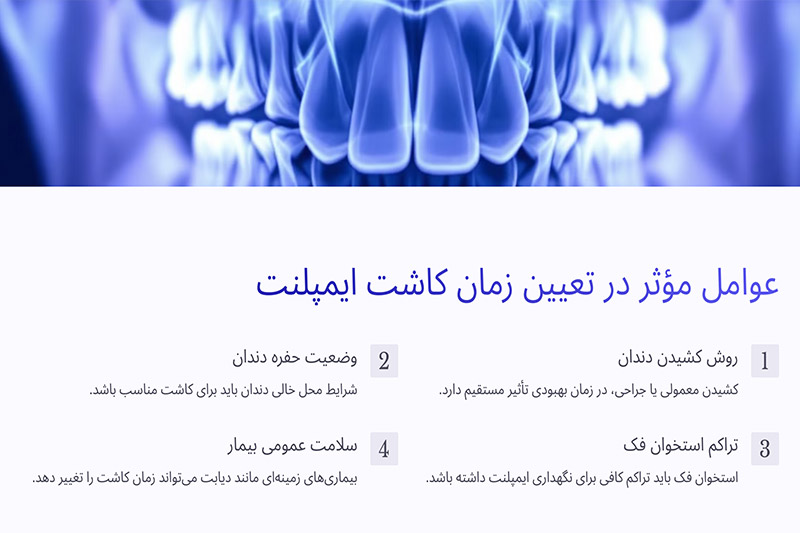 عوامل-مؤثر-بر-تعیین-بهترین-زمان-برای-کاشت-ایمپلنت