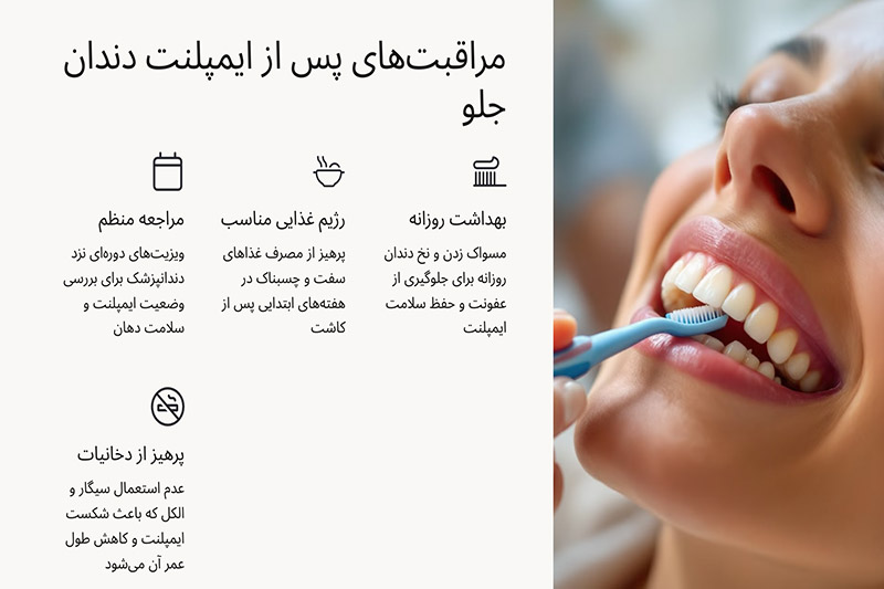 مراقبت-بعد-از-ایمپلنت-دندان-جلو