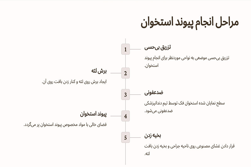 نحوه-انجام-پیوند-استخوان-در-ایمپلنت-دندان