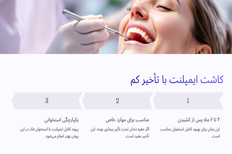 کاشت-ایمپلنت-با-تاخیر-زمانی-کم