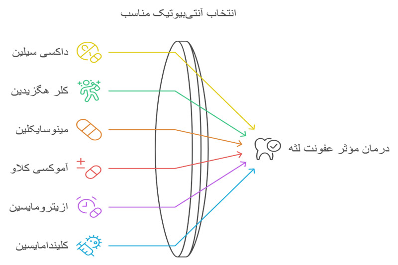 آنتی-بیوتیک-برای-عفونت-لثه-و-دندان