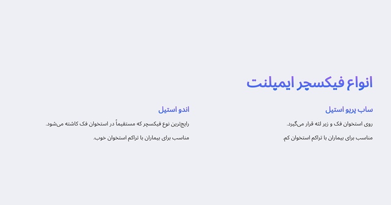 انواع فیکسچر ایمپلنت