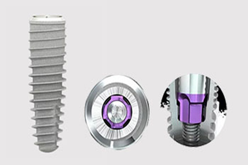 ایمپلنت-سی‌-آی‌-سی-(SIC)
