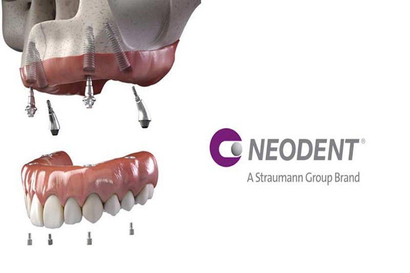 ایمپلنت-نئودنت-(NEODENT)