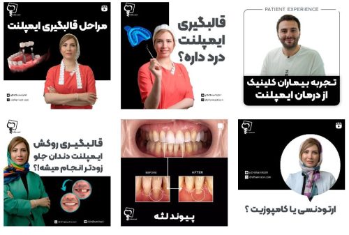 بهترین دندانپزشک زیبایی در تهران