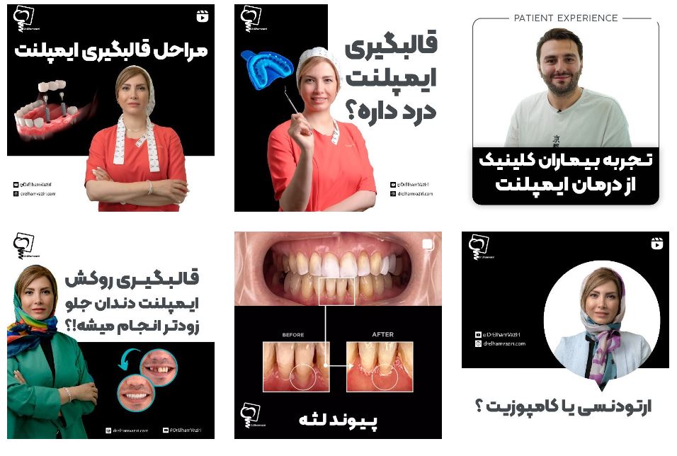 بهترین دندانپزشک زیبایی در تهران