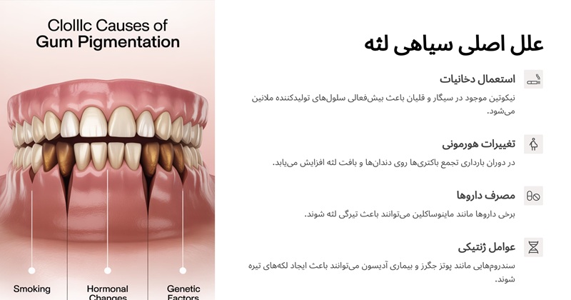 علت سیاه شدن لثه