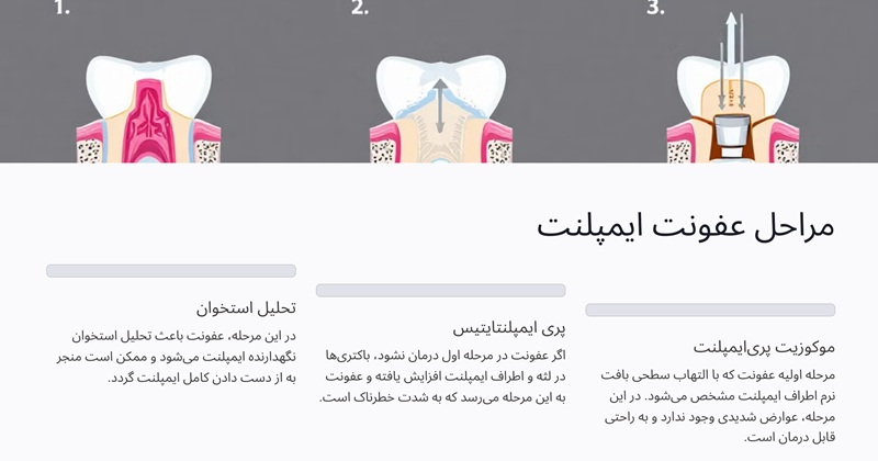 مراحل عفونت ایمپلنت