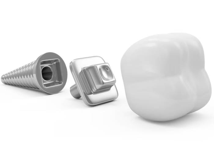 مراقبت‌های بعد از فیکسچر ایمپلنت