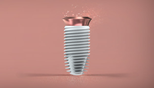 ایمپلنت-آلمانی-بیوتک-(Biotech)