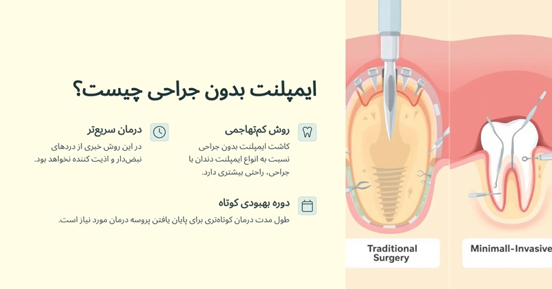 ایمپلنت بدون جراحی