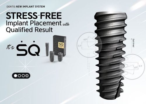 ایمپلنت دنتیس