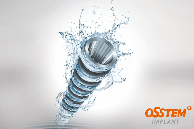 ایمپلنت-کره‌ای-اوستم