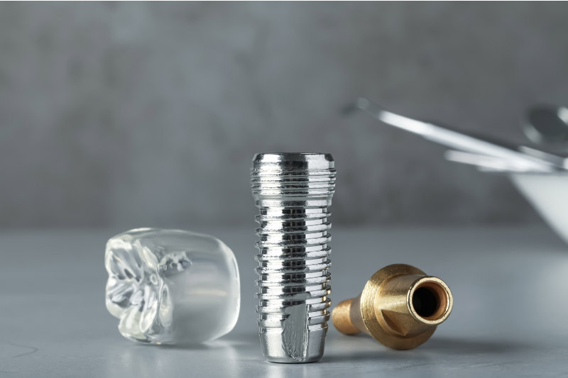  ایمپلنت-کره‌ای-دنتیس