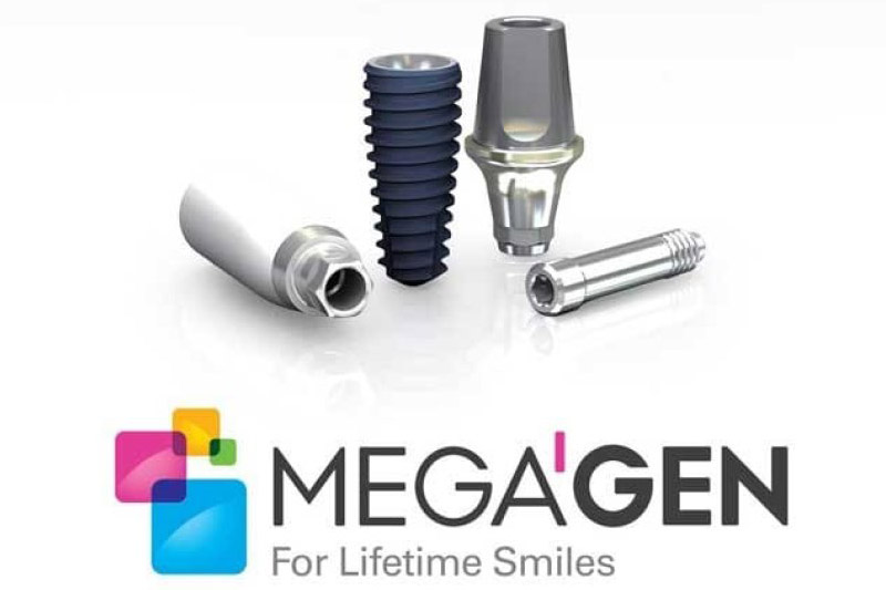 ایمپلنت-کره‌ای-مگاژن