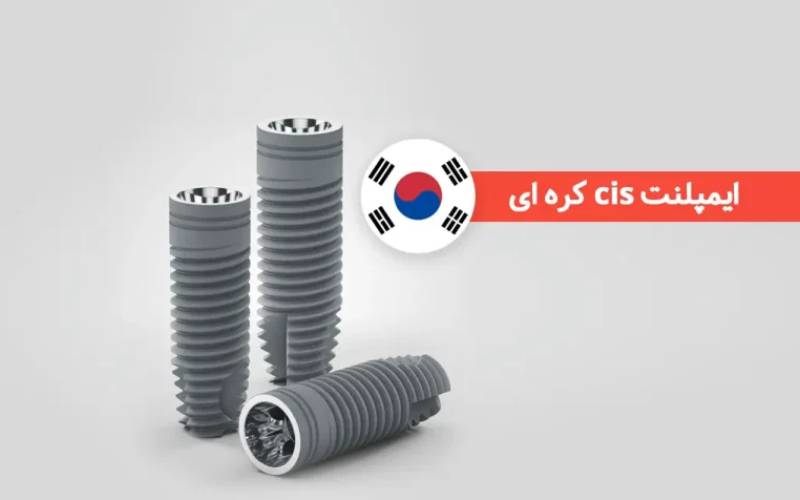 ایمپلنت کره‌ای سیز (Cis)