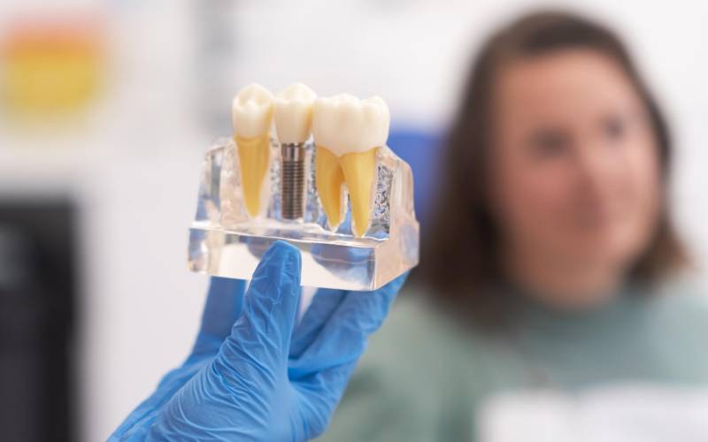 بهترین مرکز ایمپلنت در شمال تهران