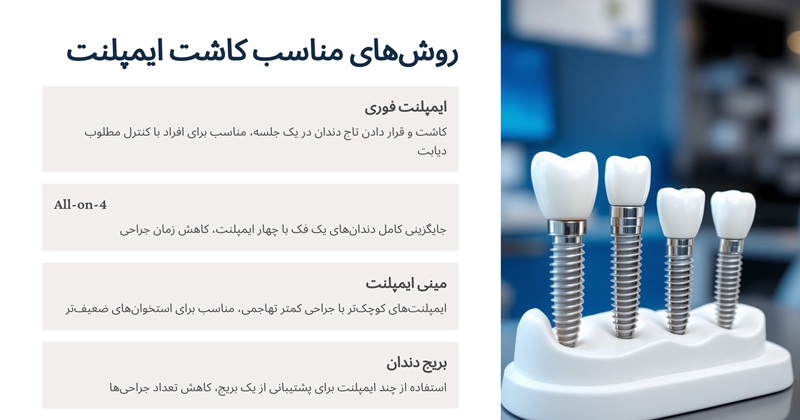 روش های مختلف کاشت ایمپلنت برای بیماران دیابتی