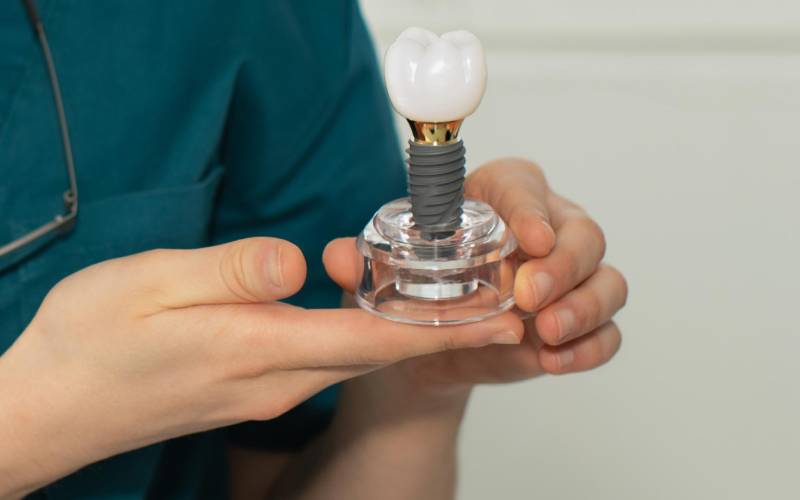 عمر ایمپلنت آلمانی