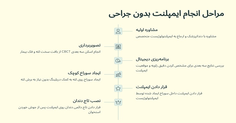 مراحل انجام ایمپلنت بدون جراحی