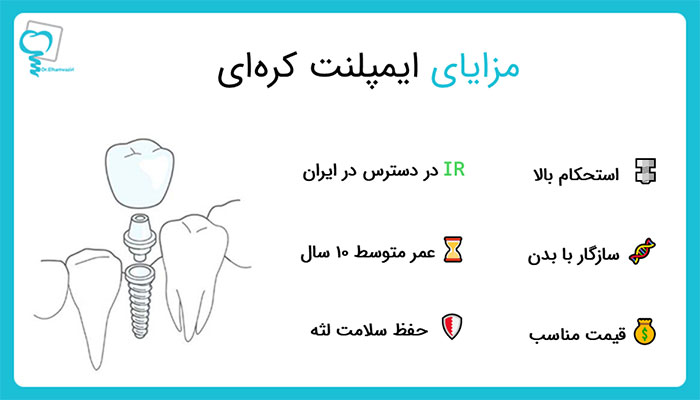 مزایای ایمپلنت کره‌ای 