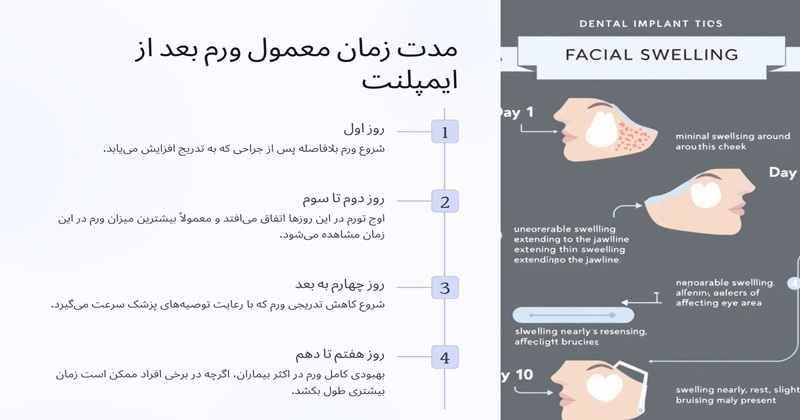 ورم صورت بعد از ایمپلنت چند روز طول میکشد؟