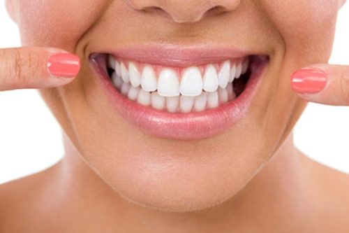 انواع روکش ایمپلنت