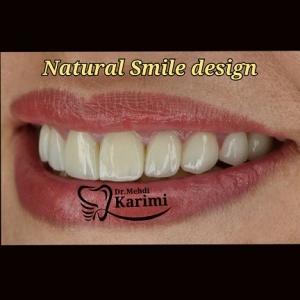 دکتر-دندان-پزشک-در-سعادت-آباد