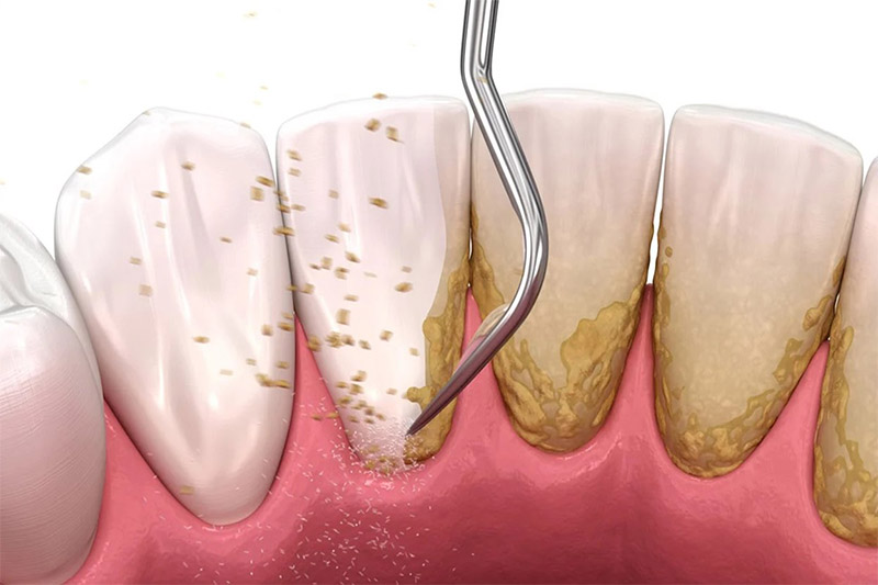 مزایای-جرم‌گیری-و-پالیشینگ
