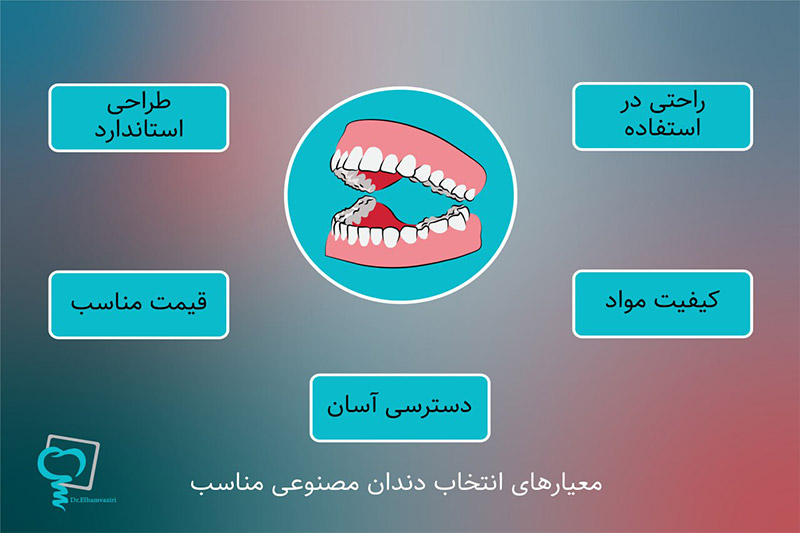 معیارهای-انتخاب-بهترین-مارک-دندان-مصنوعی