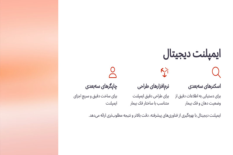 ایمپلنت-دیجیتال